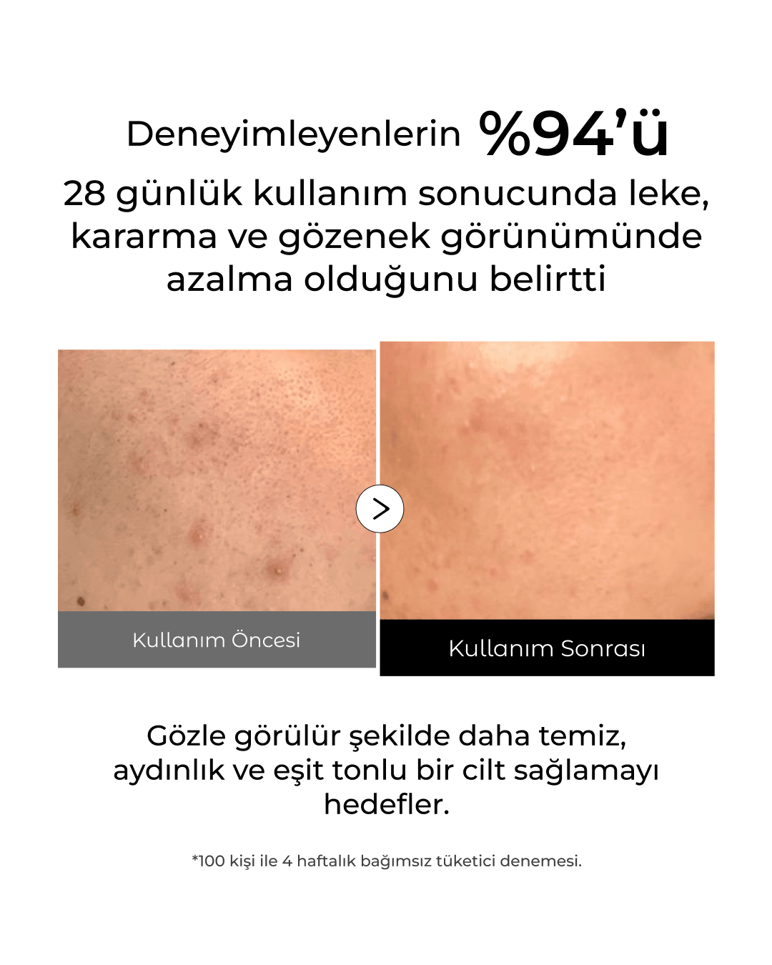 Pirinç Özlü Leke ve Gözenek Karşıtı Aydınlatıcı Clarice Peeling Maske 100 ml