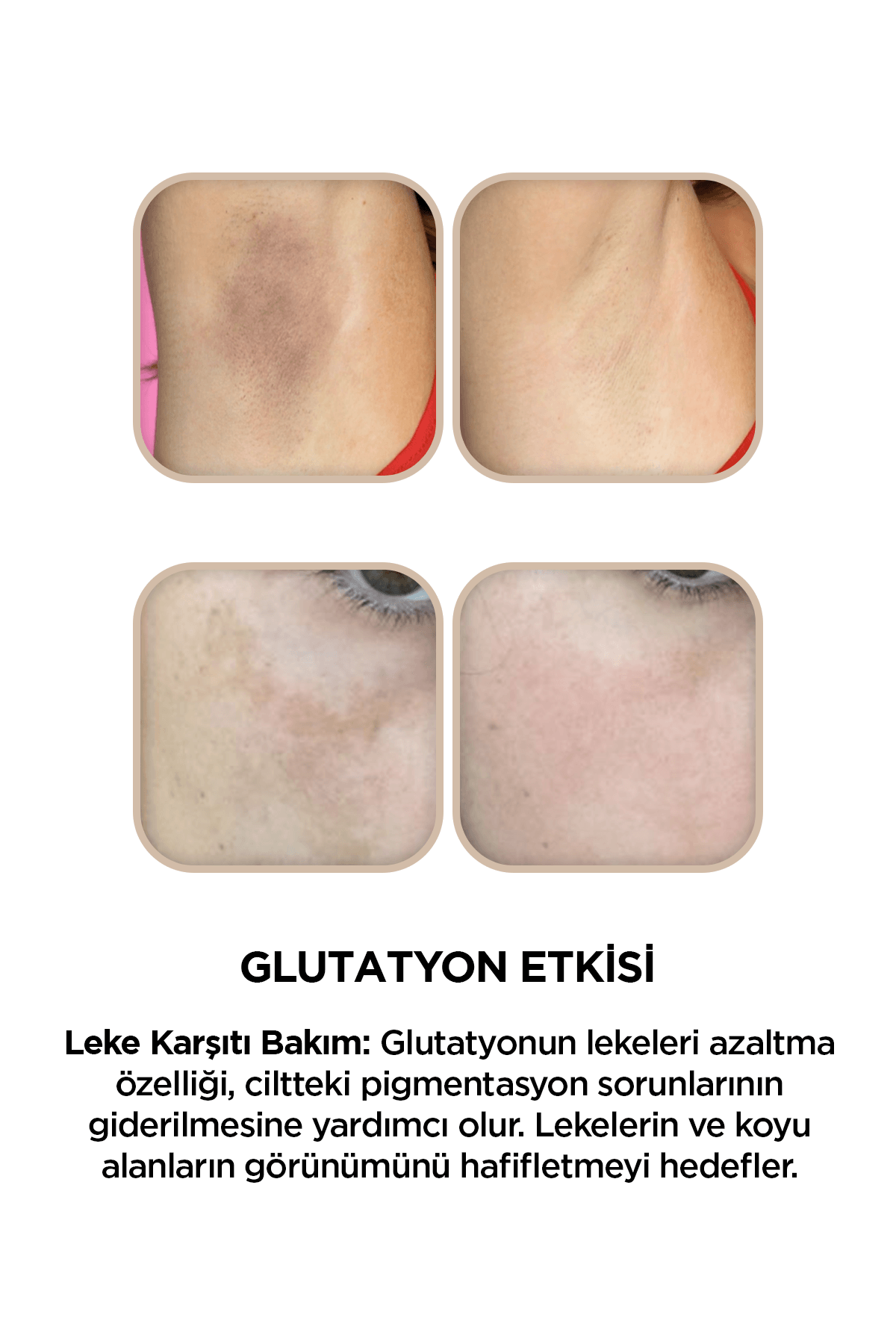 Cilt Beyazlatıcı, Leke Karşıtı Aydınlatıcı Glutatyon İçerikli Bakım Kremi 50 ml