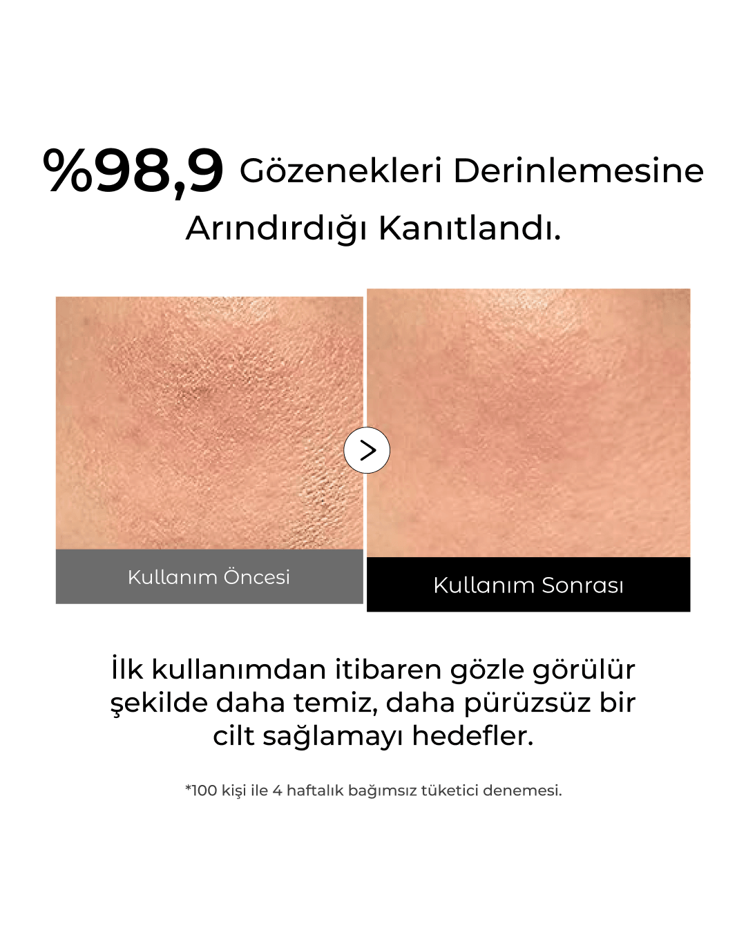 Pirinç Özlü Leke ve Gözenek Karşıtı Aydınlatıcı Clarice Peeling Maske 100 ml