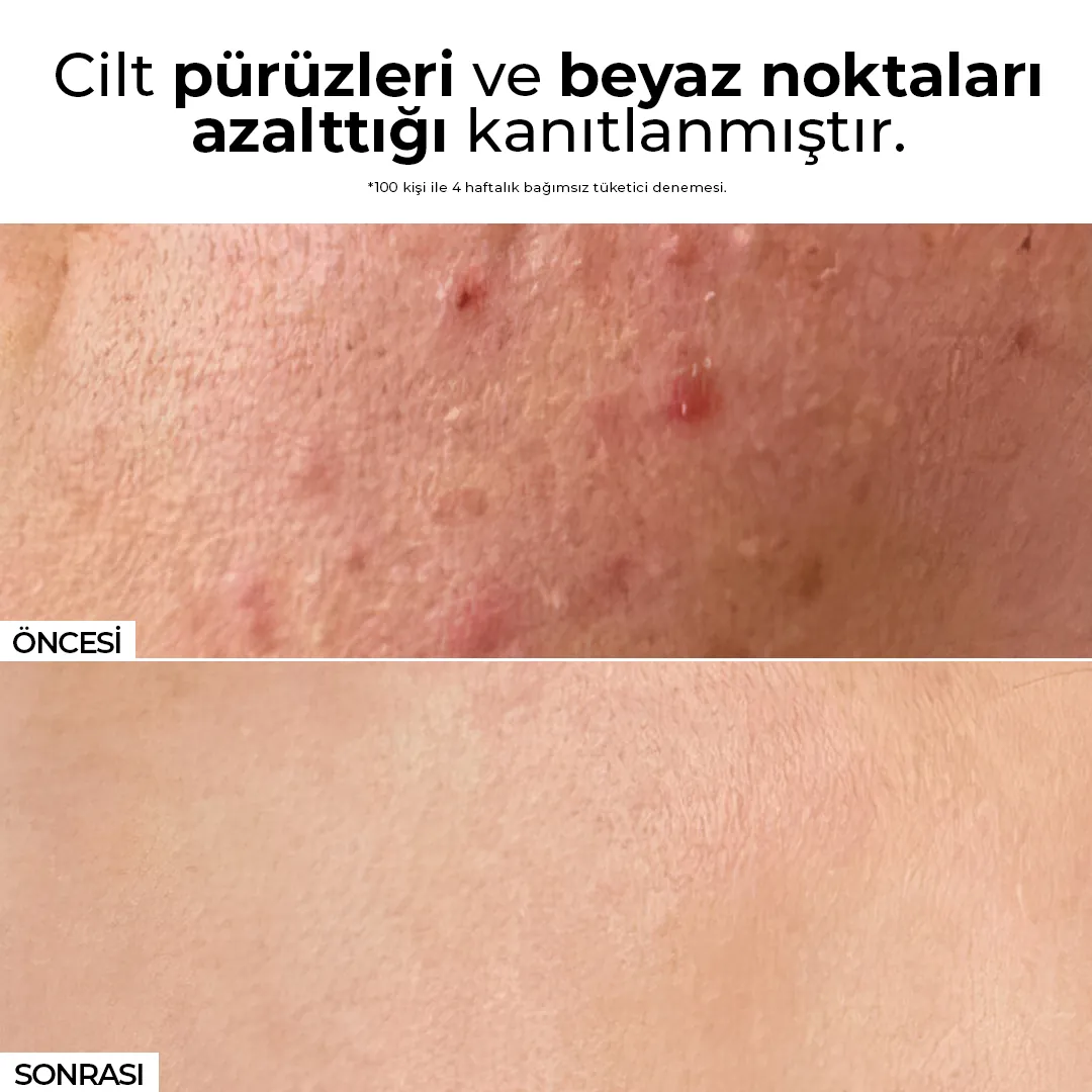 Kırmızı Kore Ginseng Özlü Anında Ölü Derilerden Arındıran, Yenileyici Aydınlatıcı Peeling 100 ml