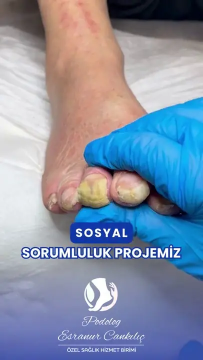Bakım sonucu video önizlemesi