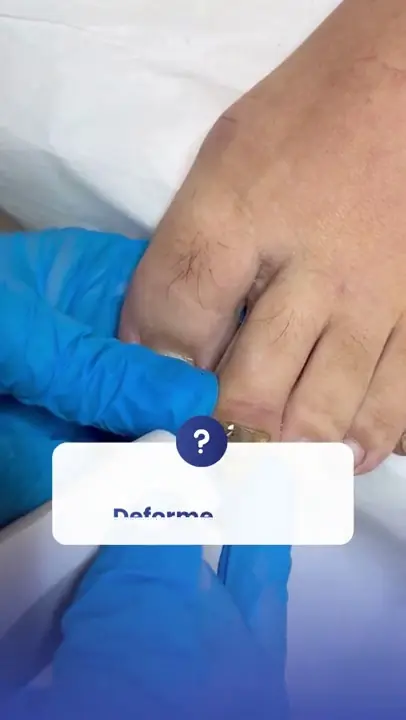 Bakım sonucu video önizlemesi