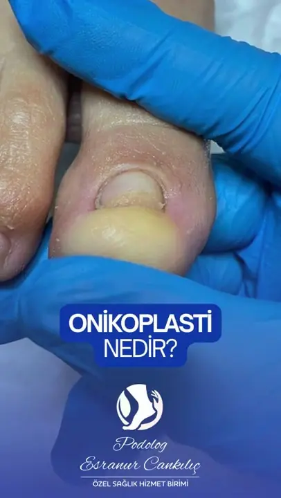 Bakım sonucu video önizlemesi