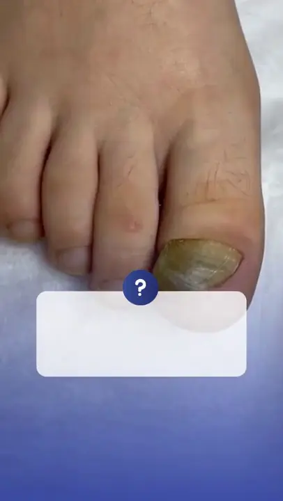 Bakım sonucu video önizlemesi