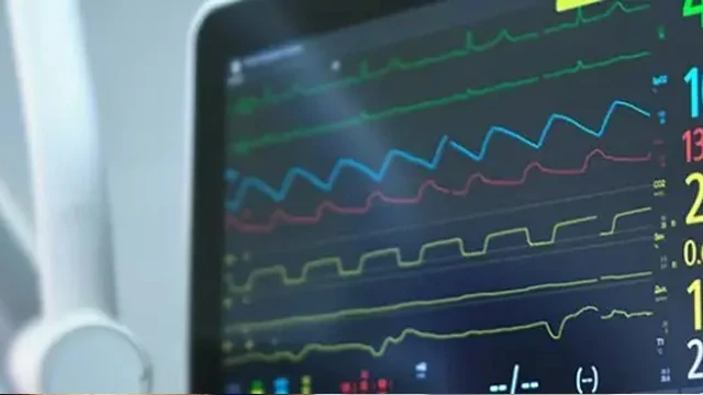 EKG Nedir? EKG Nasıl Çekilir?