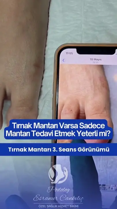 Bakım sonucu video önizlemesi
