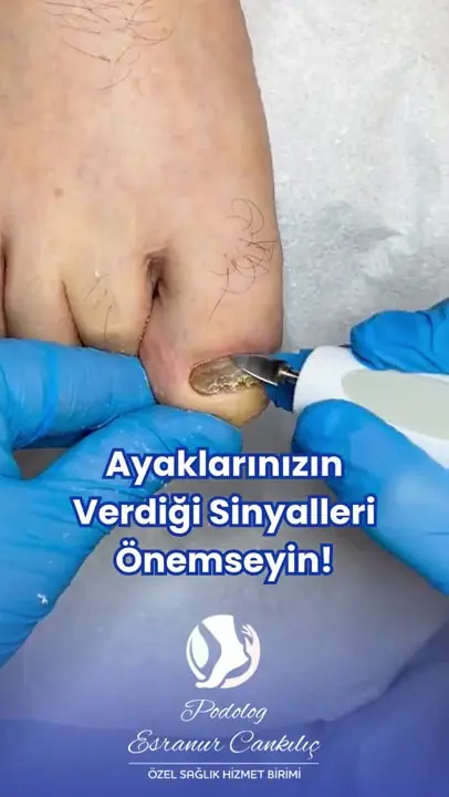 Bakım sonucu video önizlemesi