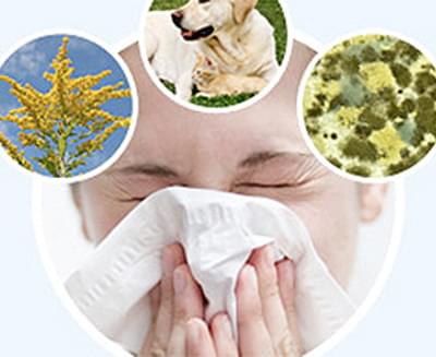 ALLERGY SERİSİ