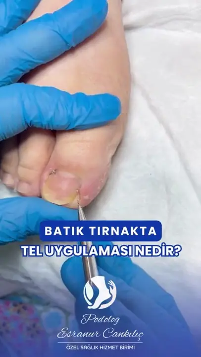 Bakım sonucu video önizlemesi